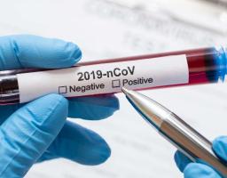 В області минулої доби лабораторно підтверджено 264 нових випадки COVID-19