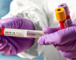 В області за добу зафіксовано одинадцять нових випадків COVID-19