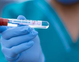 За минулу добу нових захворювань на COVID-19 в області не зафіксовано. Дві людини одужали