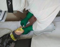 Меценат Робертас Габулас допоміг трьом лікарням області придбати венозні сканери