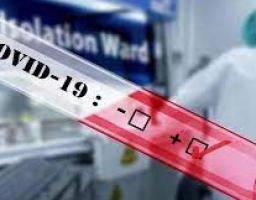 Лабораторно підтверджено 255нових випадків COVID-19 в області за минулу добу. Від ускладнень померло сім хворих