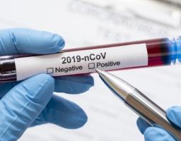 В області лабораторно підтверджено 10 нових випадків COVID-19