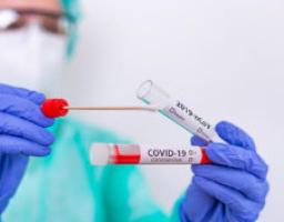 Лабораторно підтверджено 302 нових випадків COVID-19 в області. Від ускладнень померло ще дев’ятеро хворих