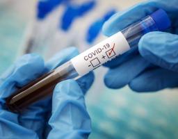 Лабораторно підтверджено 716 нових випадків COVID-19 в області за минулу добу. Від ускладнень померло ще п’ятеро хворих