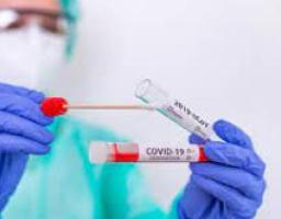 Лабораторно підтверджено 58 нових випадків COVID-19 в області. Померло три людини