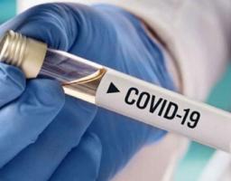 В Україні лабораторно підтверджено 16 993 нових випадки COVID-19 за минулу добу. На Луганщині – 245