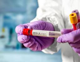 Зафіксований черговий антирекорд підтверджених випадків COVID-19 в області – 193 за добу 