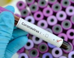 Померли дев’ять хворих від ускладнень COVID-19 в області.  Лабораторно підтверджено ще 94 нових випадки інфікування   