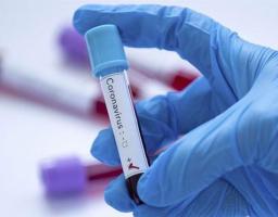 Лабораторно підтверджено 65 нових випадків COVID-19 в області. Від ускладнень померли ще один хворий