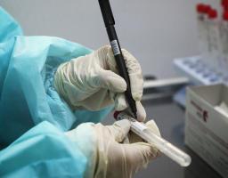 Лабораторно підтверджено дев’ять нових випадків COVID-19 в області за минулу добу