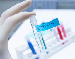 Лабораторно підтверджено 53 нових випадки COVID-19 в області. Від ускладнень померли ще сім хворих