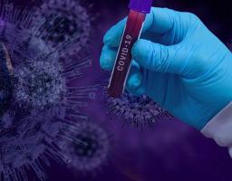 Лабораторно підтверджено 131 новий випадок COVID-19 в області. Одужали 233 пацієнти