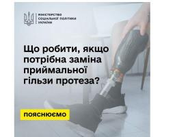Уряд спростив процедуру заміни приймальної гільзи протеза