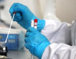 Лабораторно підтверджено 45 нових випадки COVID-19 в області 