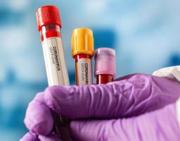 Лабораторно підтверджено шість нових випадків COVID-19 в області за минулу добу. Від ускладнень померло ще двоє хворих