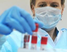 За минулу добу нових захворювань на COVID-19 в області не зафіксовано